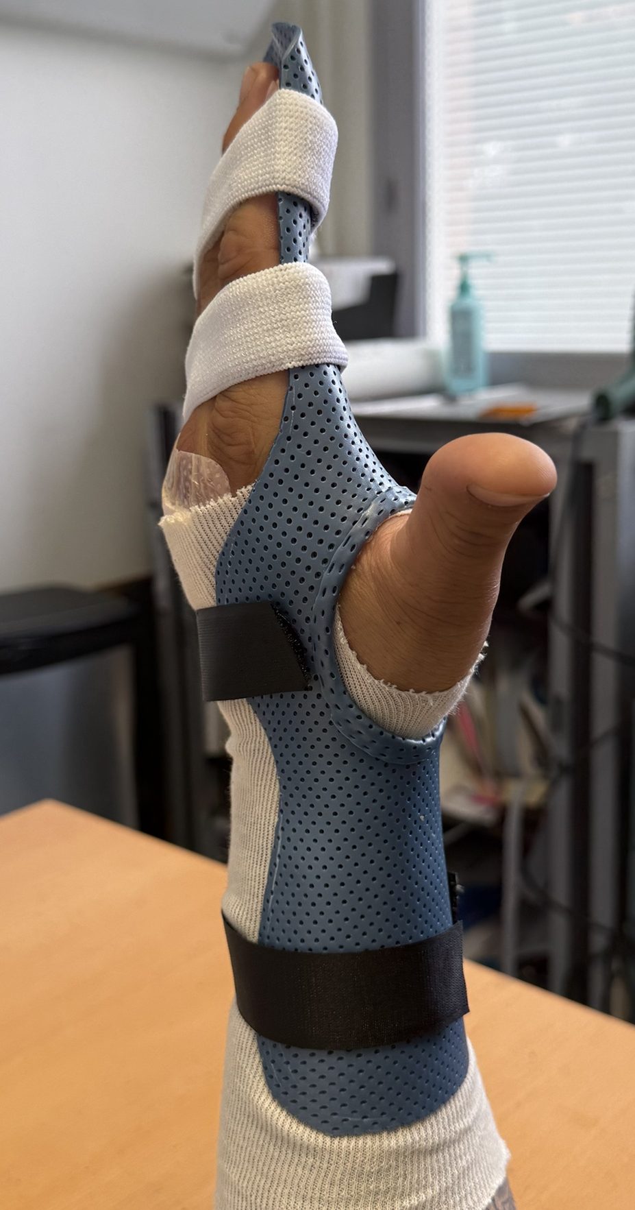 Orthèse après réparation des tendons extenseurs